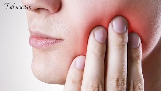 Răng khôn mọc lệch ra má có nguy hiểm không và chữa trị như thế nào?