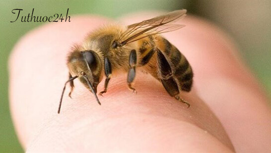 Mẹo xử lý khi bị ong đốt hiệu quả, đúng cách và nhanh chóng