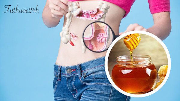 Người bệnh viêm đại tràng có thể uống mật ong không ?
