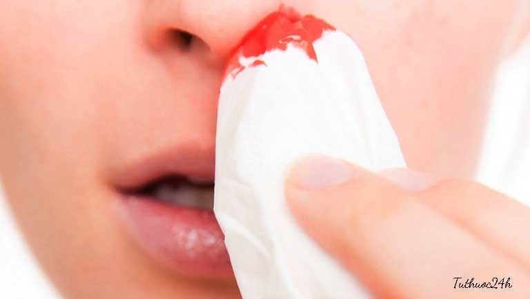 Viêm xoang chảy máu mũi - Nguyên nhân - Cách xử lý hiệu quả