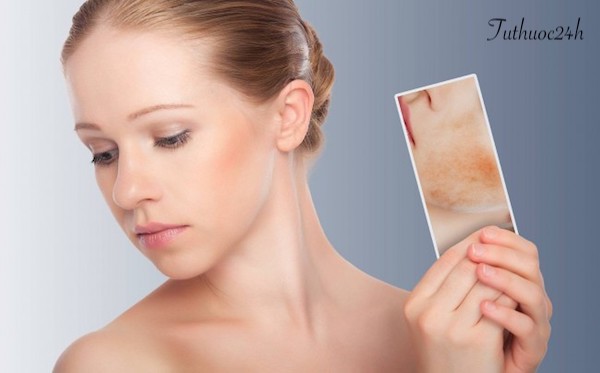 Luôn giữ sạch da thường xuyên để tránh bị mụn khi mang thai