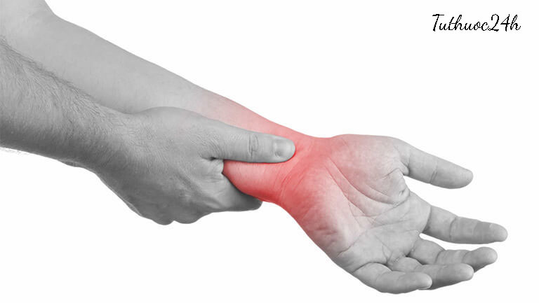 Những thông tin quan trọng mà bạn cần biết về viêm khớp cổ tay