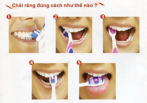 Đánh răng đúng cách giúp bạn ngăn ngừa hôi miệng