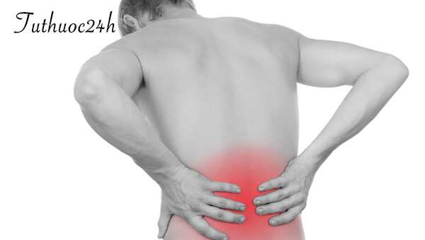Hội chứng thắt lưng hông là gì? Nguyên nhân và cách điều trị