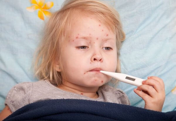 Dấu hiệu nổi ban khi trẻ bị sốt siêu vi