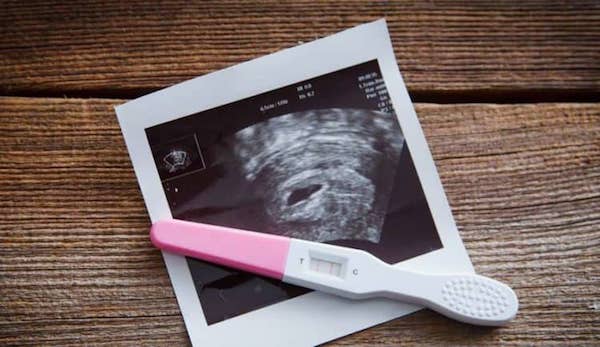 Cơ chế hoạt động của que thử thai chính là nồng độ HCG trong nước tiểu