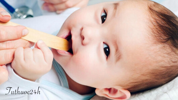 Cách nhận biết bệnh nấm lưỡi ở trẻ em nhanh nhất và sớm nhất