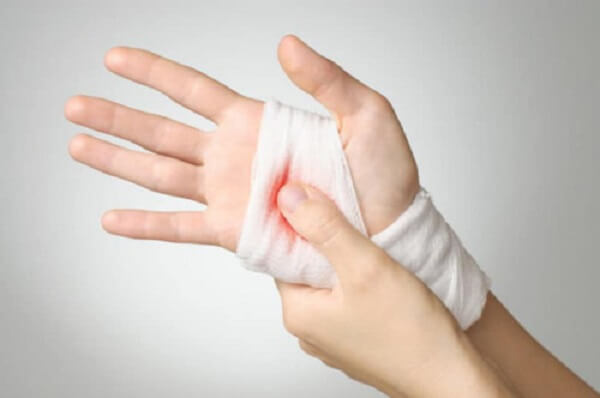 Người bệnh máu khó đông nên cẩn thận để tránh bị thương gây chảy máu