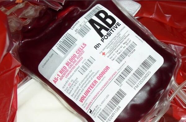 Tỷ lệ nhóm máu AB là rất ít trên thế giới