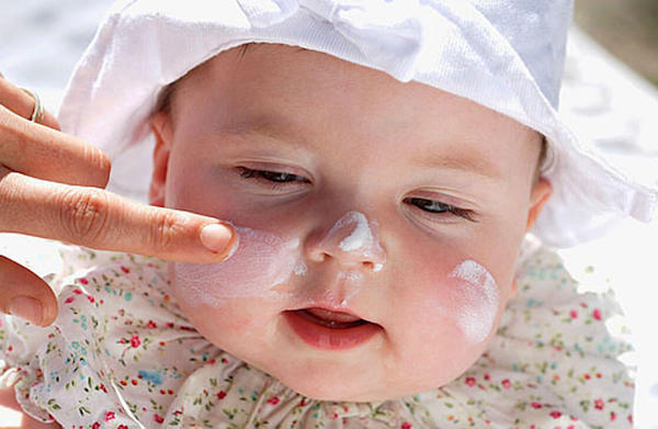  trẻ sơ sinh bị nẻ da mặt