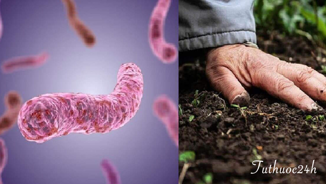 Nguy hiểm của vi khuẩn whitmore và những cách phòng tránh mọi người cần biết